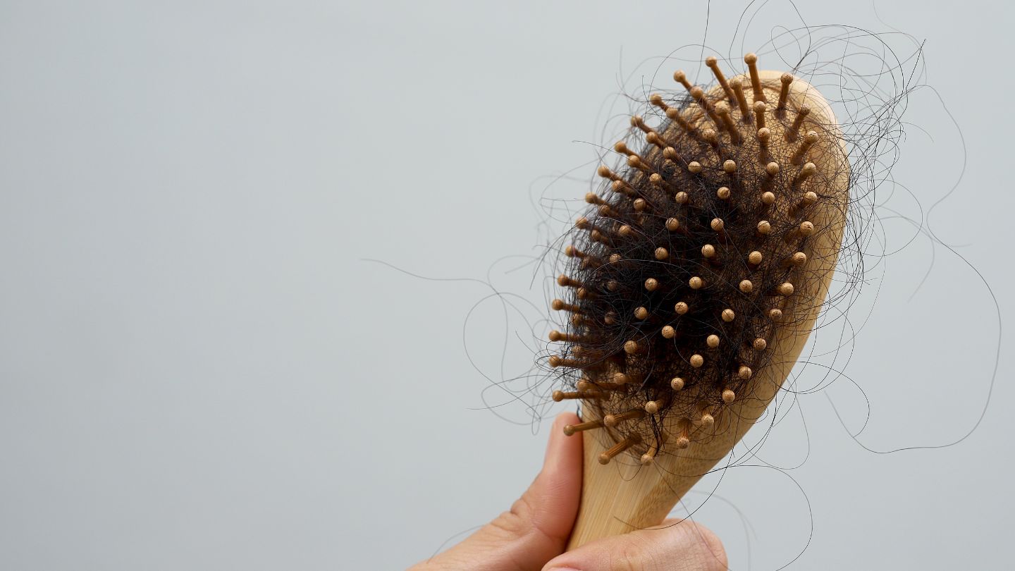 vypadávání vlasů